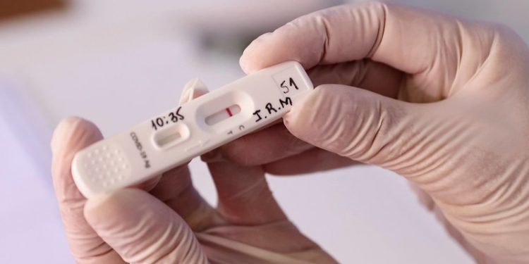 Cinco unidades de saúde serão referência para testes de Covid em pessoas assintomáticas