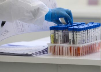 Paraná confirma 113 novos casos e mais três óbitos de H3N2