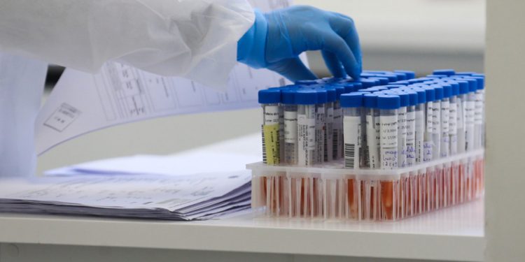 Paraná confirma 113 novos casos e mais três óbitos de H3N2