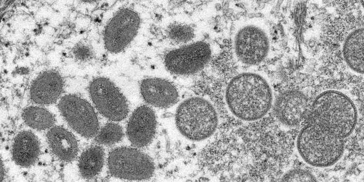 Entenda o que é a varíola dos macacos