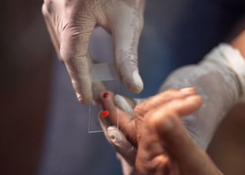 Ministério da Saúde quer zerar casos de malária no país até 2035