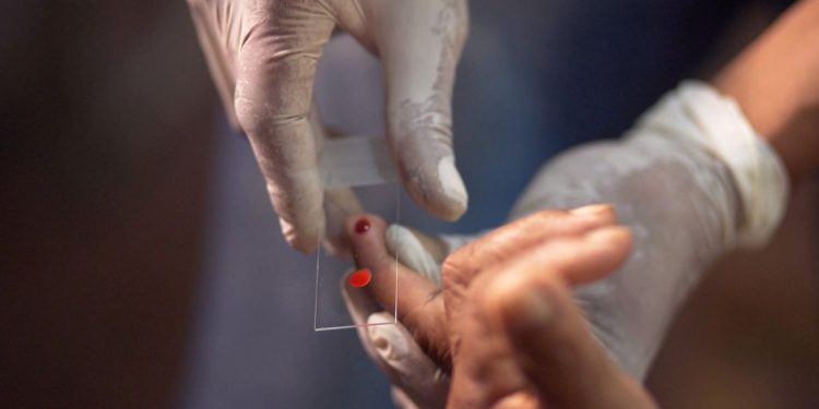 Ministério da Saúde quer zerar casos de malária no país até 2035