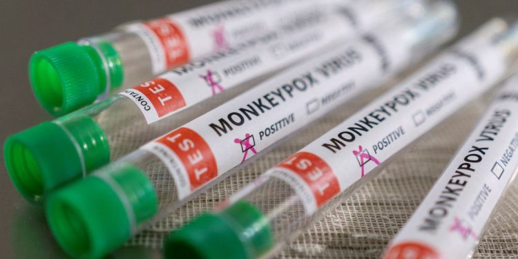 Capital paulista confirma 3 casos de varíola dos macacos em crianças