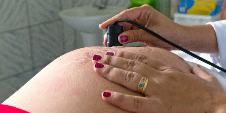 Gravidez na adolescência é maioria nos países em desenvolvimento