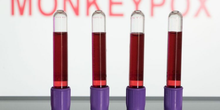 Primeiras vacinas contra varíola dos macacos devem chegar em setembro