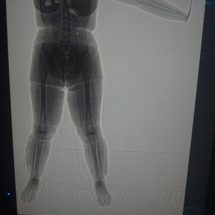 Paraguaia é presa com 2,415 kg de cocaína, no Aeroporto de Foz