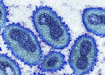 Foz do Iguaçu confirma primeiro caso de monkeypox