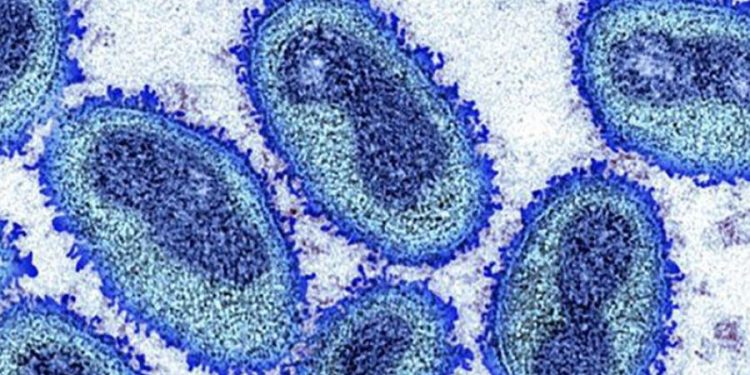 Foz do Iguaçu confirma primeiro caso de monkeypox