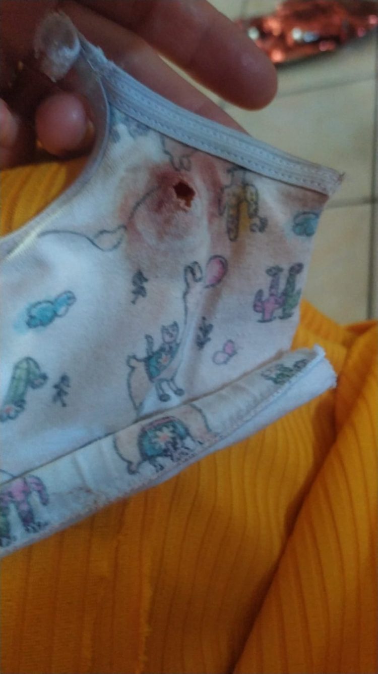 “Foi um milagre”, diz pai da menina atingida por uma bala perdida em Foz