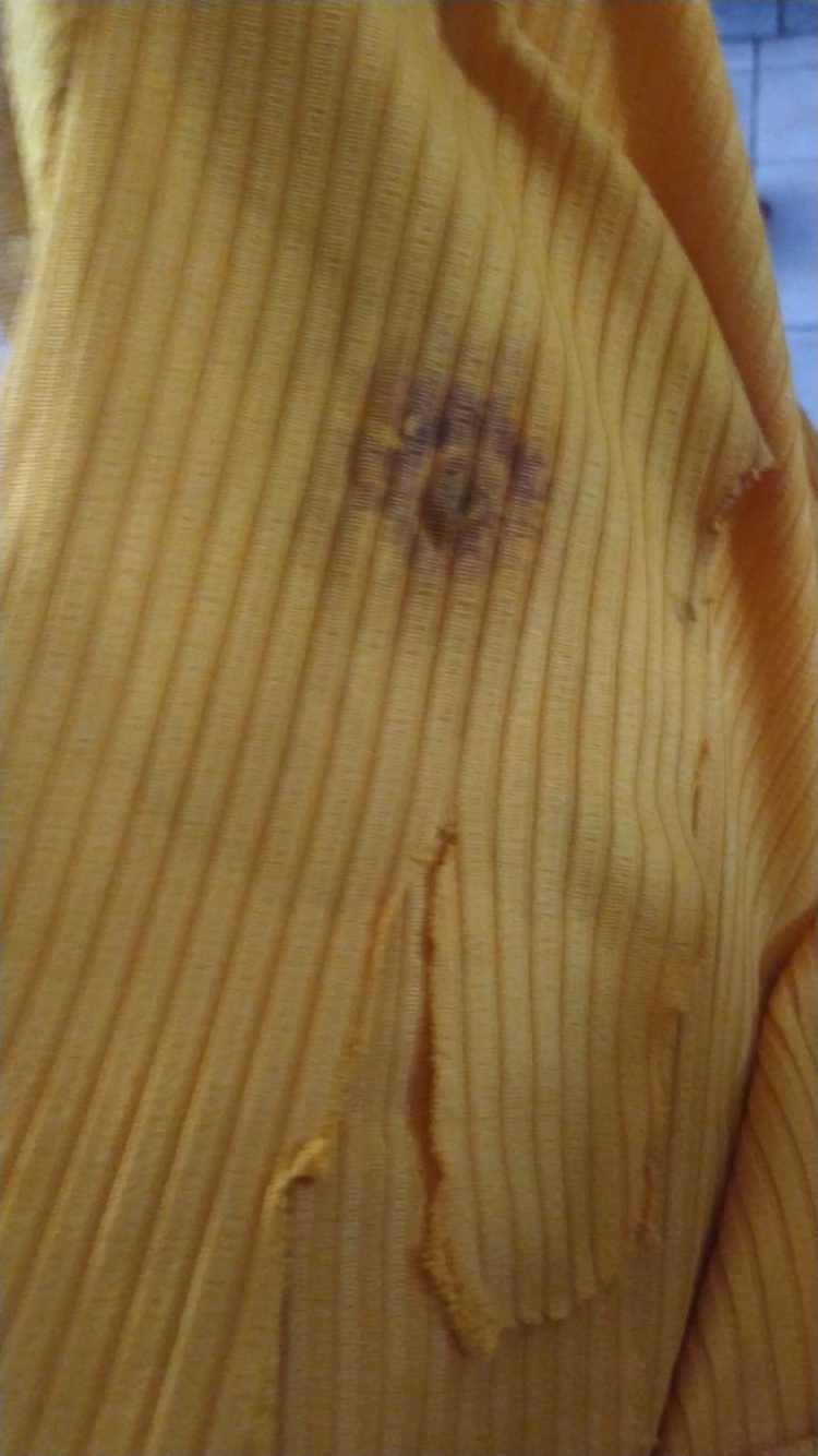 “Foi um milagre”, diz pai da menina atingida por uma bala perdida em Foz