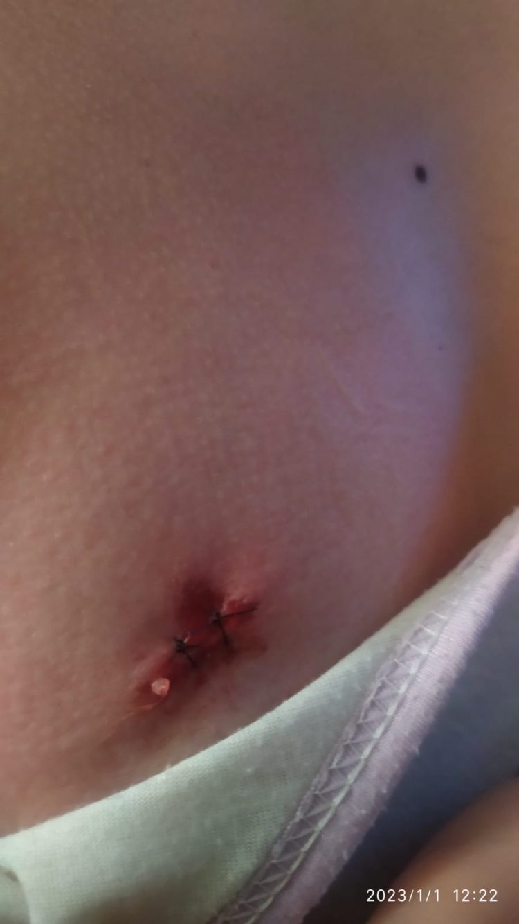 “Foi um milagre”, diz pai da menina atingida por uma bala perdida em Foz