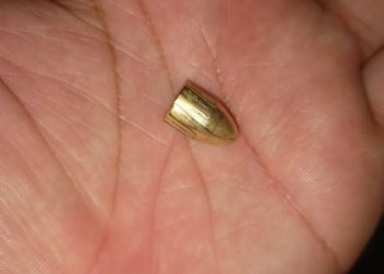 “Foi um milagre”, diz pai da menina atingida por uma bala perdida em Foz