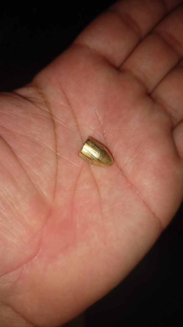 “Foi um milagre”, diz pai da menina atingida por uma bala perdida em Foz