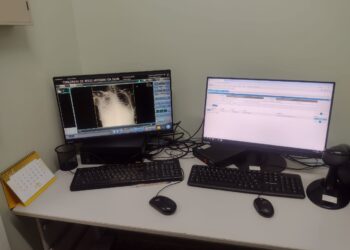 Computador reaparece e raio-x da UPA Walter Barbosa volta a funcionar