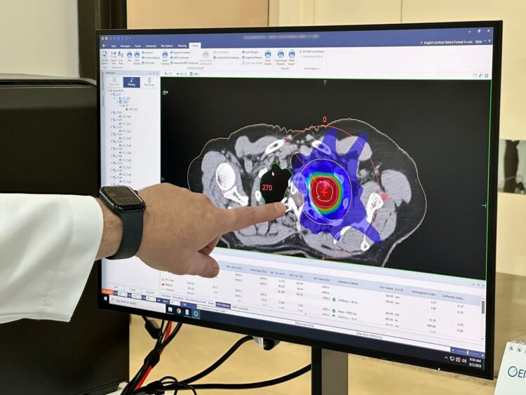 Hospital Costa Cavalcanti utiliza técnica inédita no tratamento contra o câncer