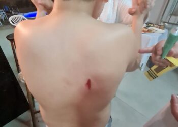 Criança é atingida por bala perdida na virada do ano em Foz do Iguaçu