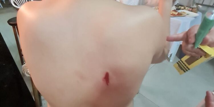 Criança é atingida por bala perdida na virada do ano em Foz do Iguaçu