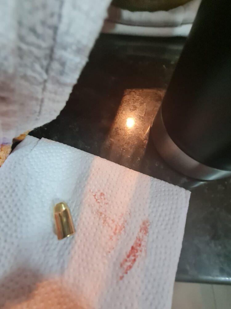 Criança é atingida por bala perdida na virada do ano em Foz do Iguaçu