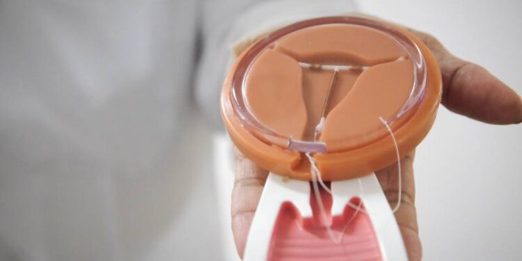 Médicos das UBS fazem capacitação para acelerar fila pela colocação de DIU