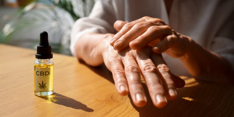 UNILA abre inscrições para pesquisa inovadora com Cannabis no combate à psoríase