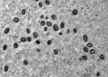 Caso de Mpox atendido em Foz marca primeiro registro da doença no Paraná em 2026